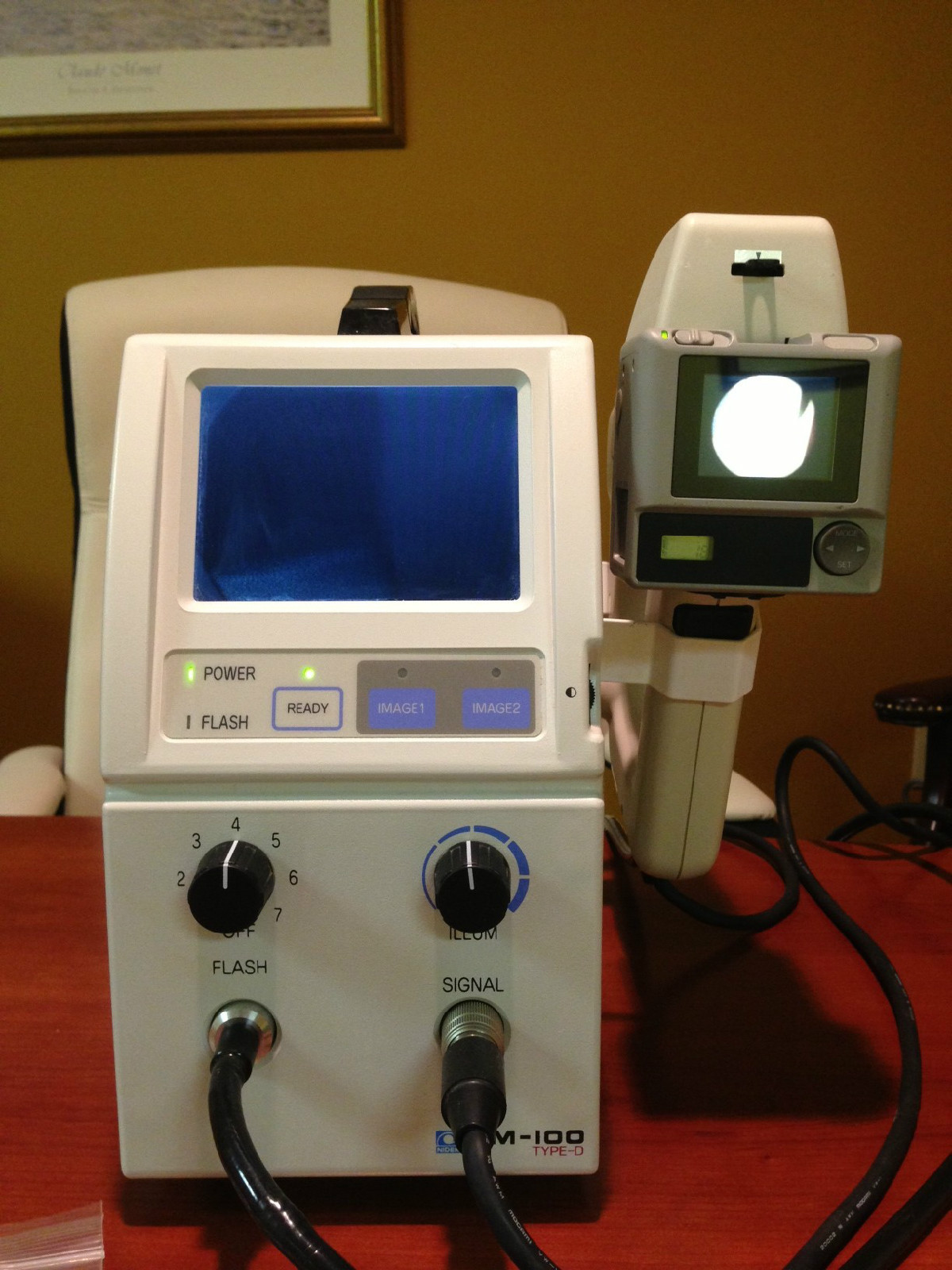 Nidek NM100D Handheld Digital Non Mydriatic Portable Fundus Camera 600x800 photo 倪dek NM100D Handheld Digital Non Mydriatic Portable Fundus Camera 600x800 Nidek NM100D Handheld Digital Non Mydriatic Portable Fundus Camera